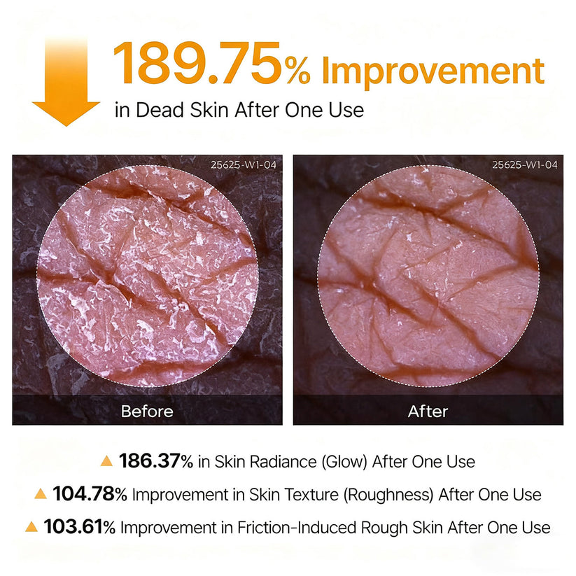 Tkhotpick Peel Shot - Kojic + Turmeric Body Peel Spray